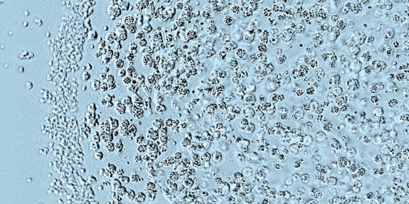 A tumoroid, colon cancer cells grown in 3D