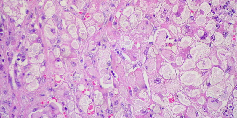 Liver hepatocytes